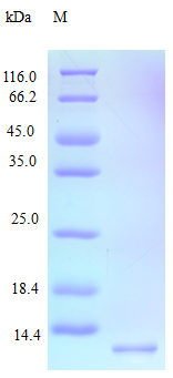 Human CCL15 protein (Active)