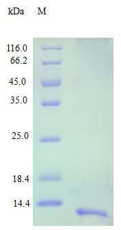Human CCL16 protein (Active)