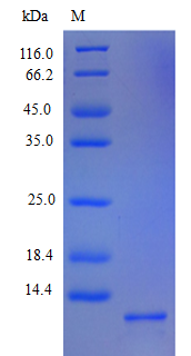 Human CXCL5 protein (Active)