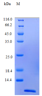 Human CCL2 protein (Active)
