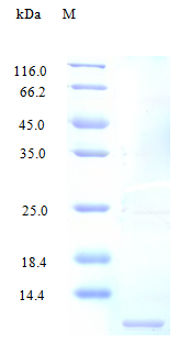 Human CCL4 protein (Active)