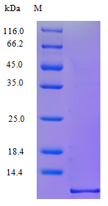 Human CCL5 protein (Active)