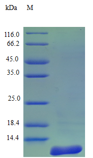 Human CCL7 protein (Active)