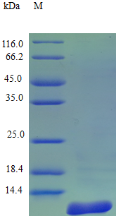 Human CCL8 protein (Active)