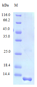 Human CCL21 protein (Active)