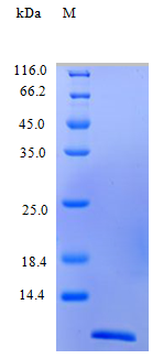 Human CCL22 protein (Active)