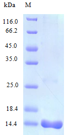 Human CCL25 protein (Active)