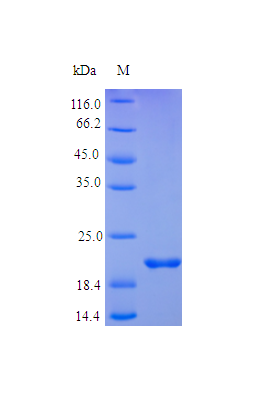 Human ONCM protein (Active)