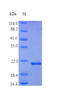 Human ONCM protein (Active)