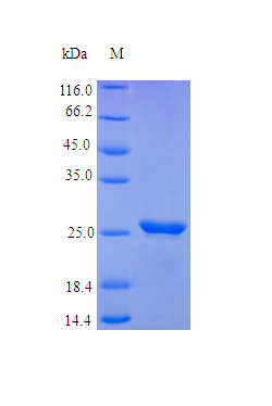 Human ONCM protein (Active)