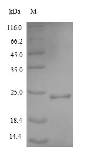 Human NOGG protein (Active)