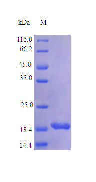 Human TNFL9 protein (Active)