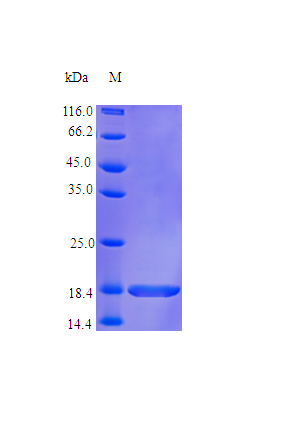 Human TNFA protein (Active)