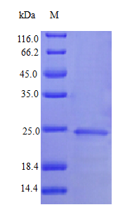 Human IFNA1 protein (Active)