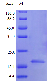 Human IFNA2 protein (Active)