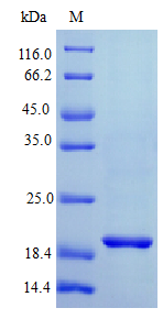 Human IFNL1 protein (Active)