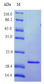 Human IFNW1 protein (Active)