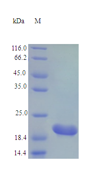 Rat CTF1 protein (Active)