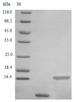 Human UTER protein (Active)