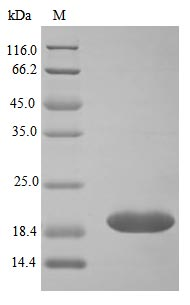 Human NGAL protein (Active)