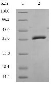 Human CASP14 protein