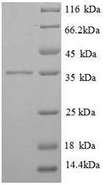 Human FCER1G protein