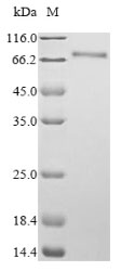 Human MKI67 protein