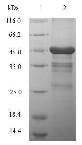 Human MMP12 protein
