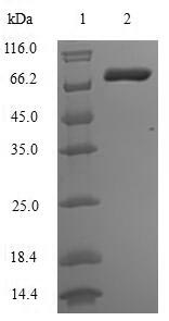 Human MMP14 protein