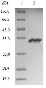 Human RYR3 protein