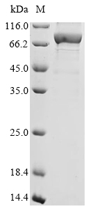 Human HNRNPM protein