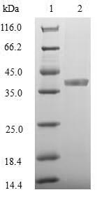 Parasite MSA2 protein