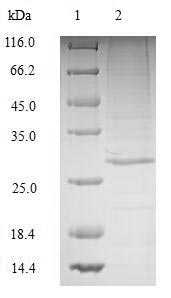 Human C1QTNF3 protein