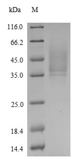 Human BTC protein