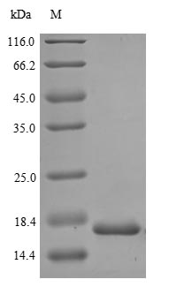 Human MKI67 protein