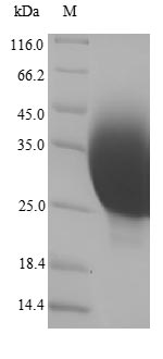 Human MT1X protein