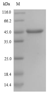 Human NES protein