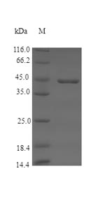 Pig F12 protein