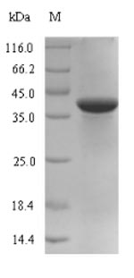 Bacterial MPN_083 protein