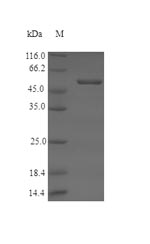 Mouse ROS1 protein