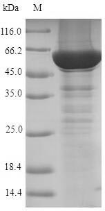 Human CYP21A2 protein
