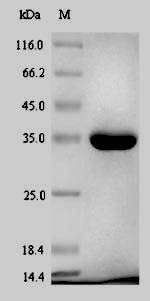 E. coli gmhA protein