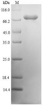 Human DCP1A protein