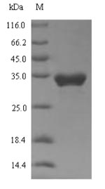 Human TRPA1 protein