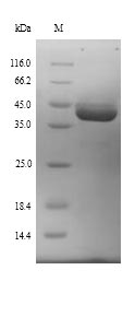 Mouse Ube3a protein