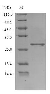 Viral ORF3 protein