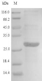 Human AIMP2 protein