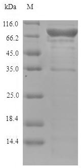 Human LOXL4 protein