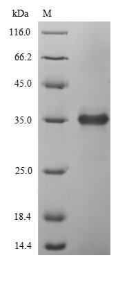 Viral T4 Lysozyme protein