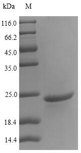 Plant Major pollen allergen Car b 1 isoform 2 protein